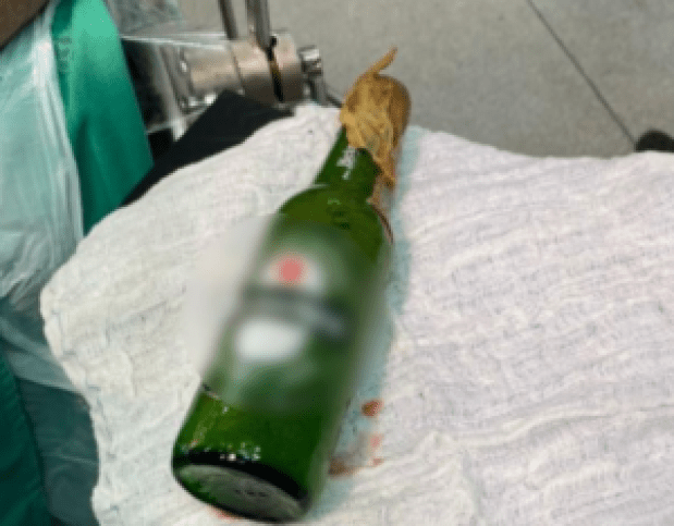 Jovem e socorrido após enfiar garrafa de Heineken no ânus
