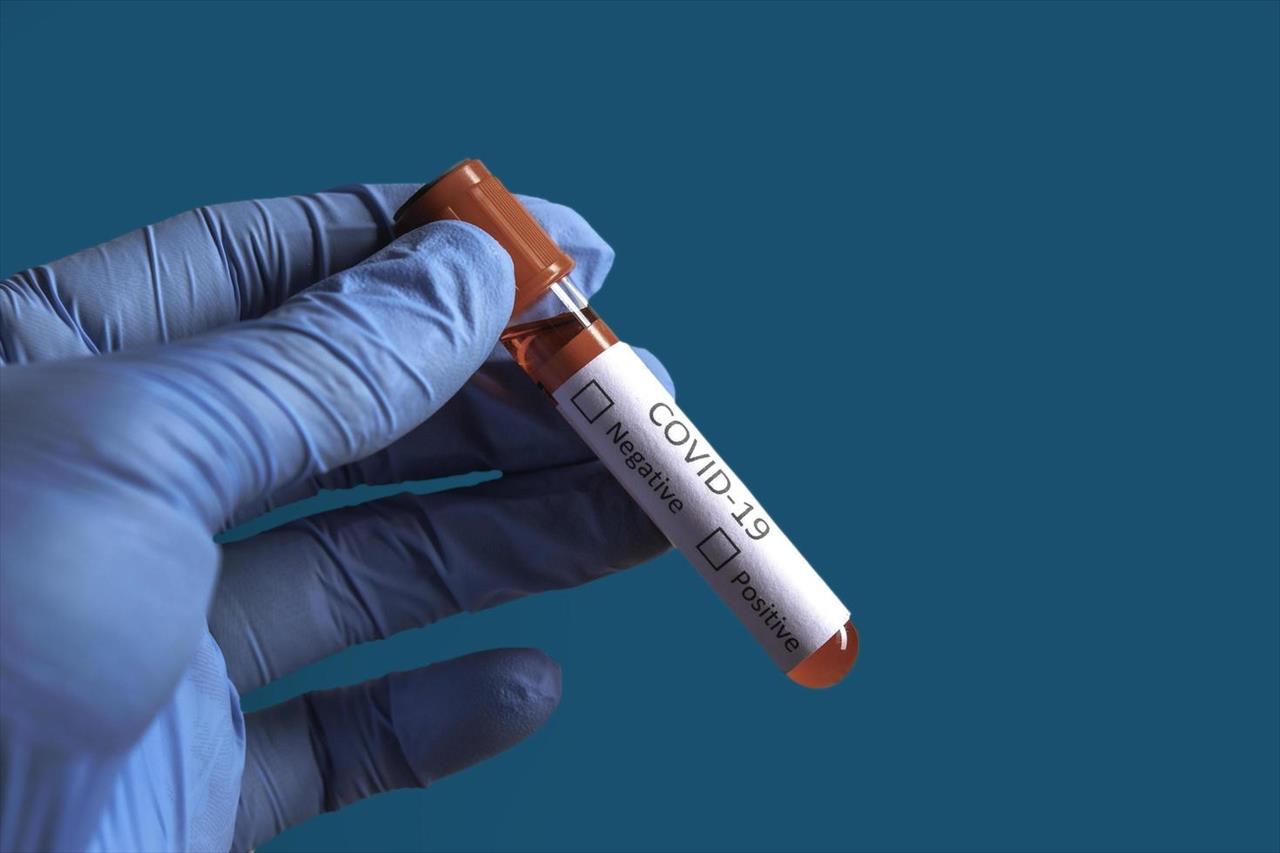 Após quase 1 ano de pandemia, China resolve testar amostras de sangue para investigar origem da Covid-19