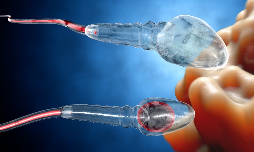 Na Alemanha, mulher  ganha prêmio ao criar ultrassom que neutraliza os espermatozoides