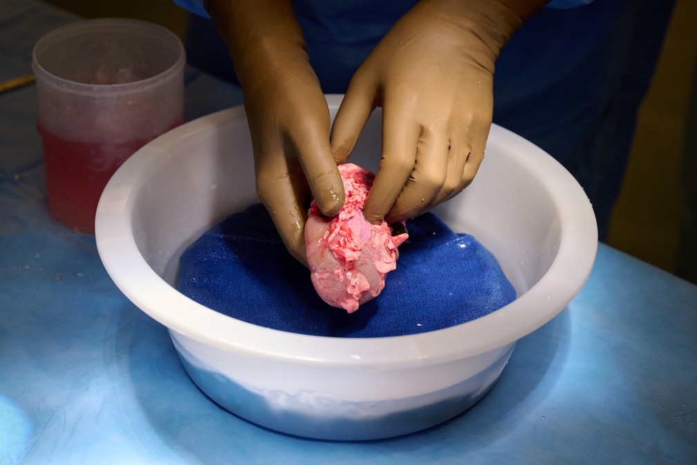 Transplante de rim de porco em humano é realizado pela 1ª vez com sucesso em Nova York