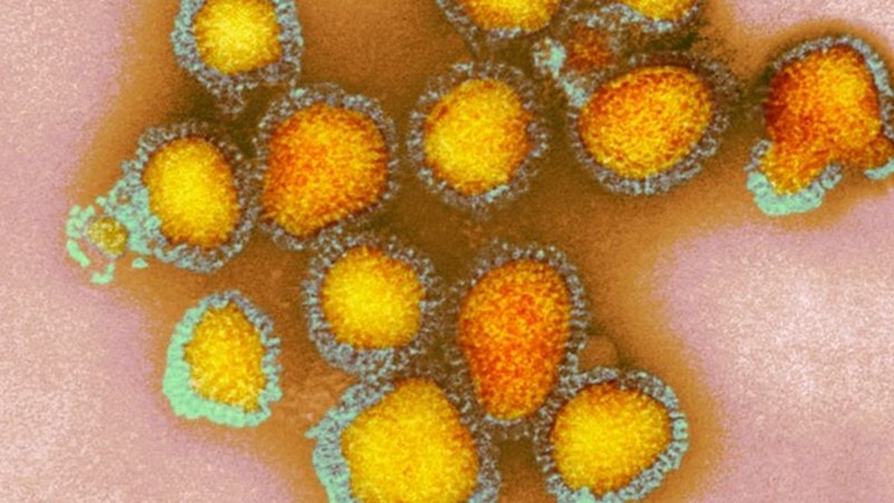 Bahia registra primeira morte por variante H3N2