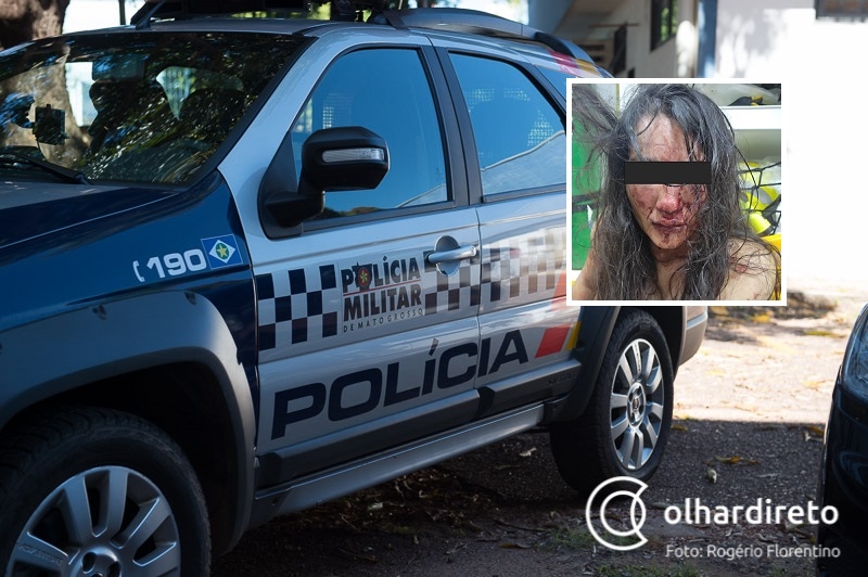 Mulher tem rosto deformado pelo marido ao se recusar a voltar para casa com ele