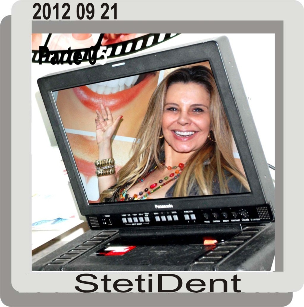 Stetident