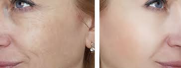 ANTES X DEPOIS, PODE? ANTES X DEPOIS, PODE?