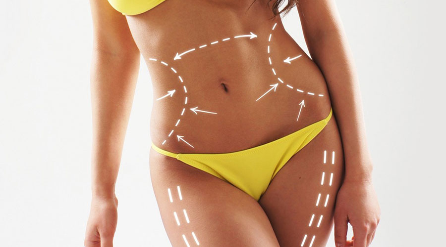 Capacitação em Hidrolipoclasia Não Aspirativa Capacitação em Hidrolipoclasia Não Aspirativa