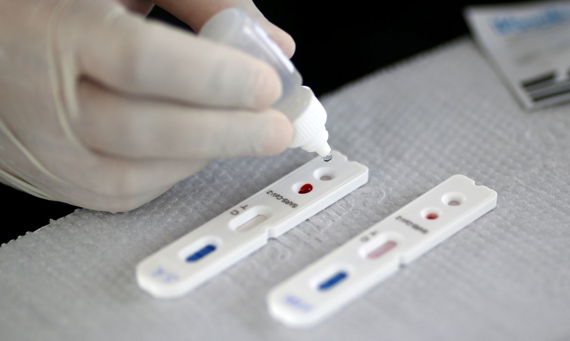 Procon-SP fiscaliza preços abusivos de testes de Covid-19