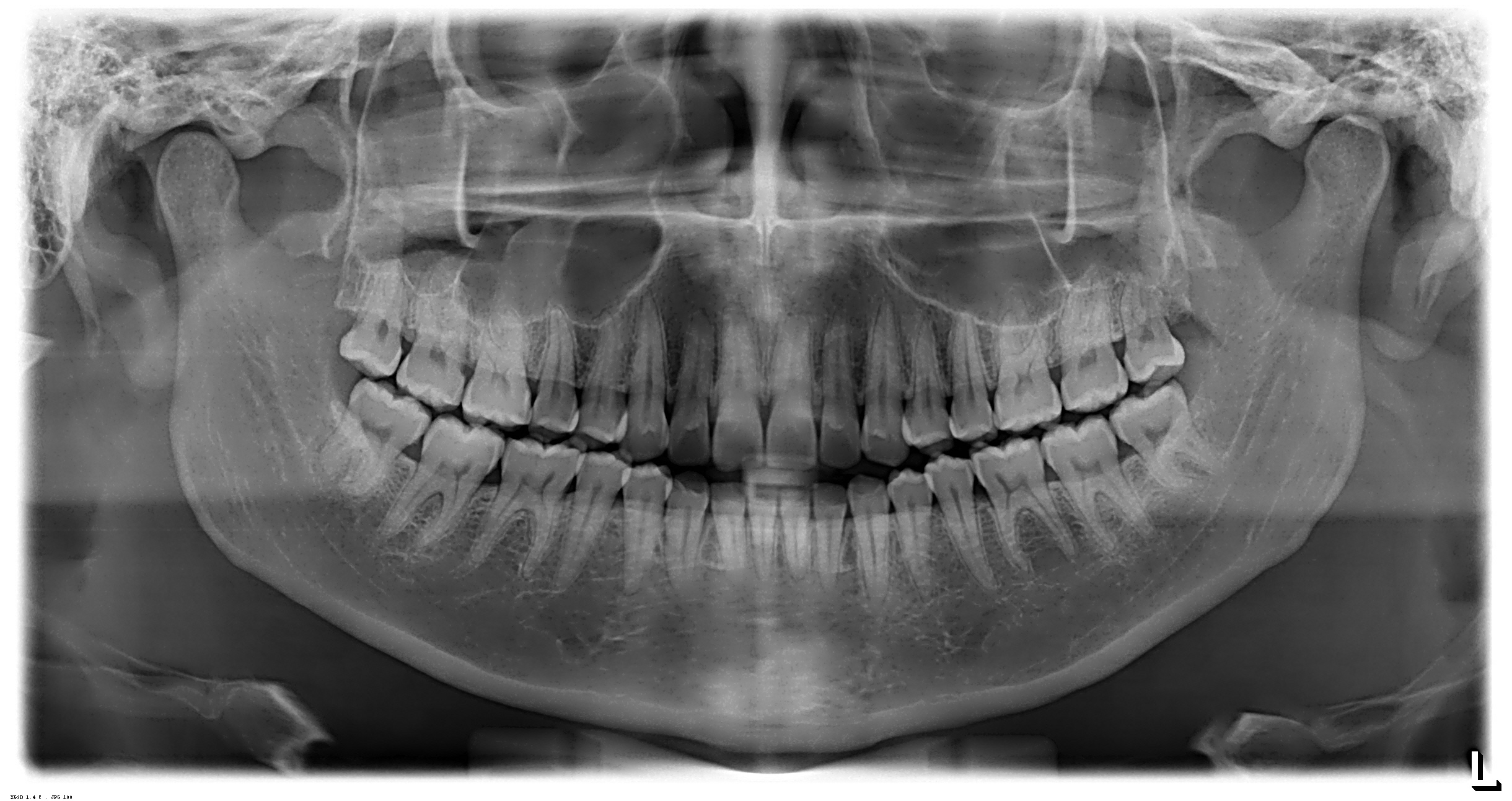 Radiografias Extrabucais